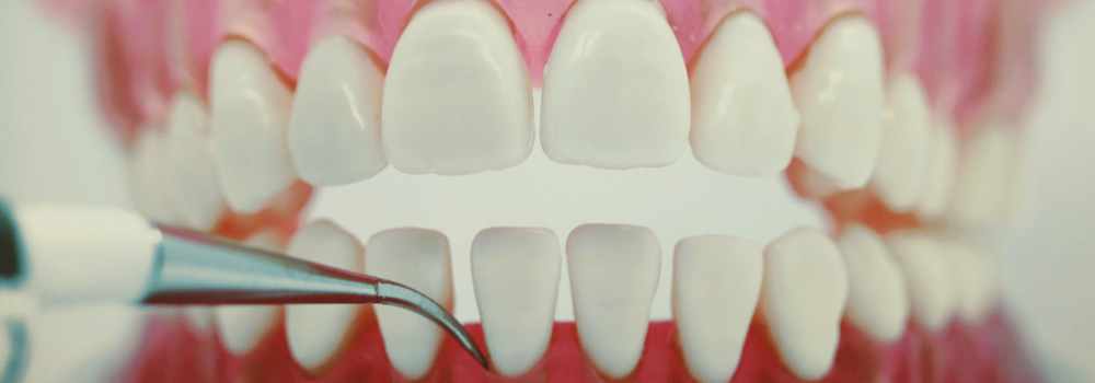 ultrasonic cleaner being used on model of teeth