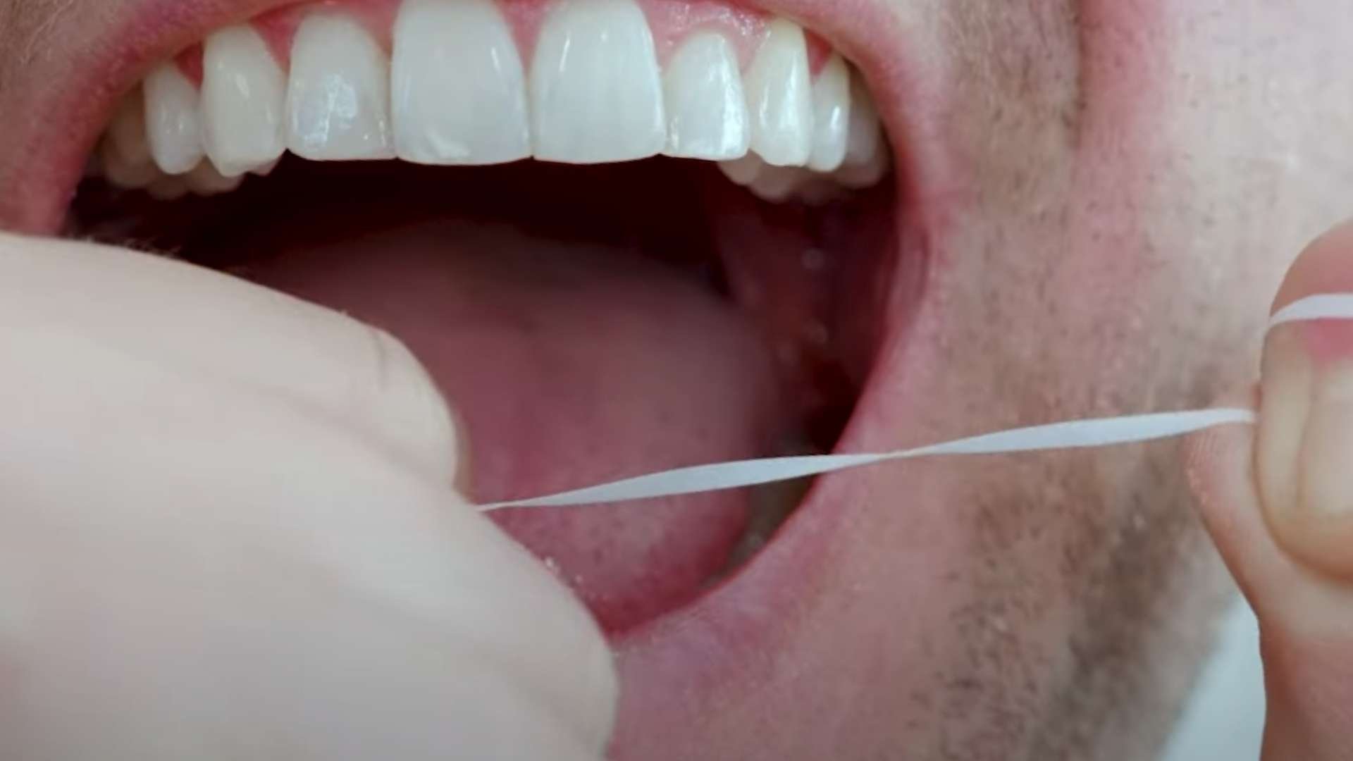 What to do when floss gets stuck in your teeth 2