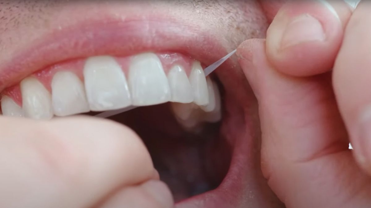 What to do when floss gets stuck in your teeth 1
