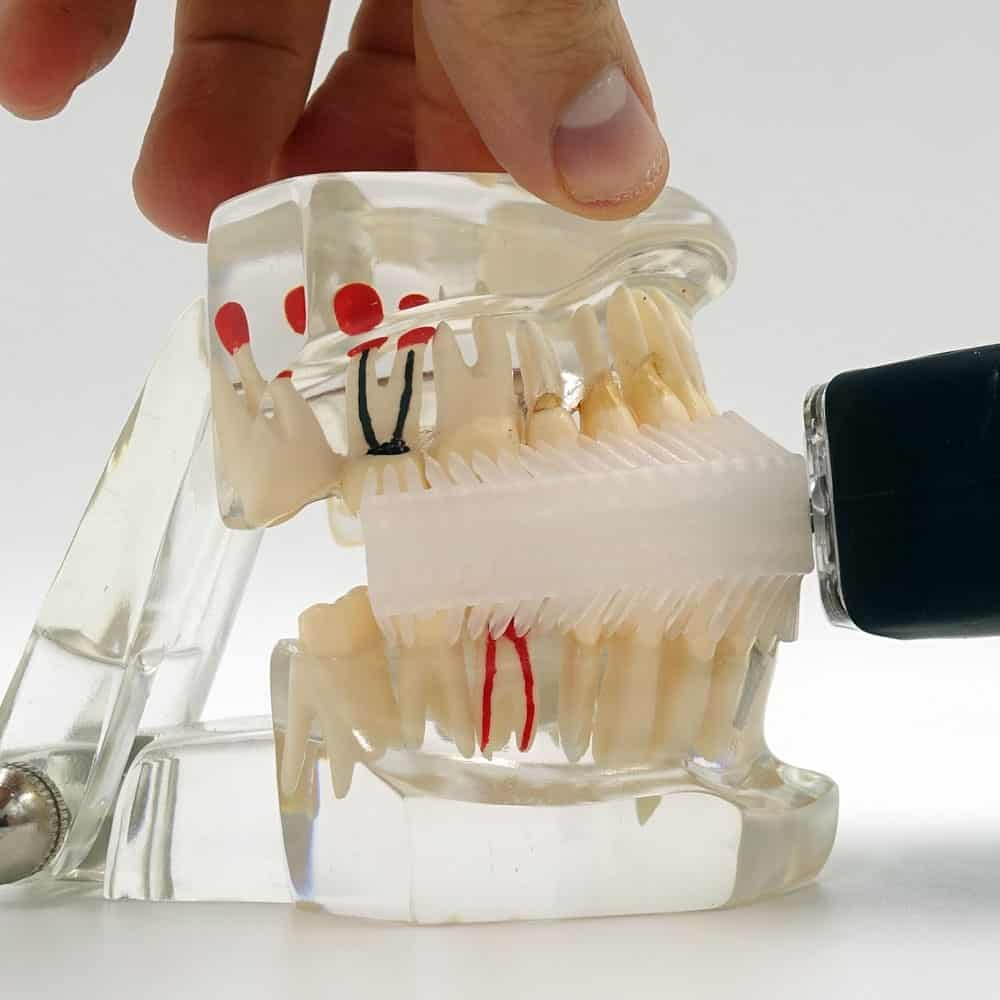 Mouthpiece toothbrushes: think twice before you buy 24