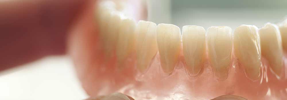 Dentures: a guide to types of false teeth & their costs 9