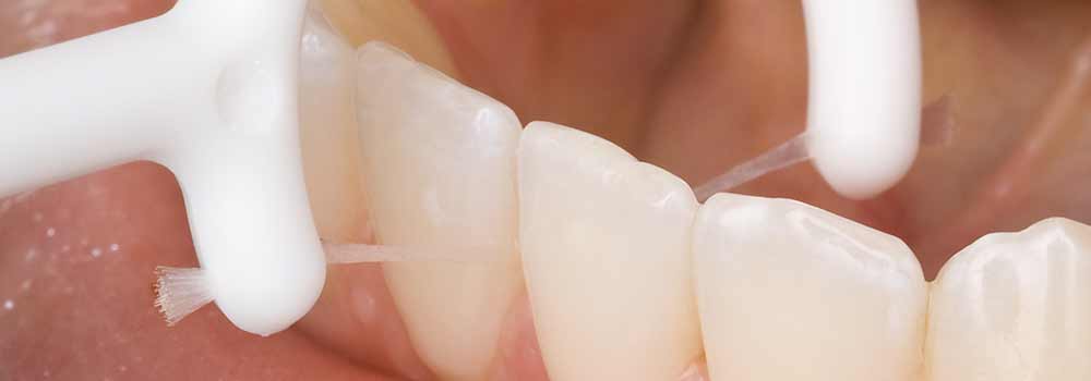 Bleeding gums when brushing teeth 11