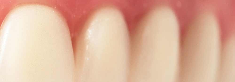 Bleeding gums when brushing teeth 6
