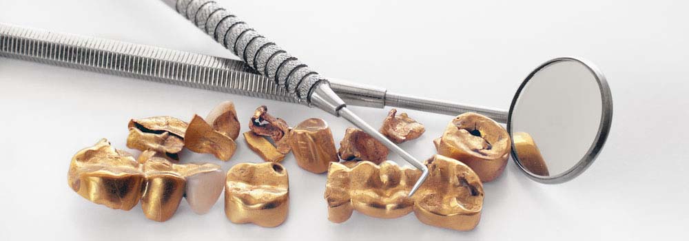 Dental Crowns & Tooth Caps: Costs, Procedure & FAQ 11