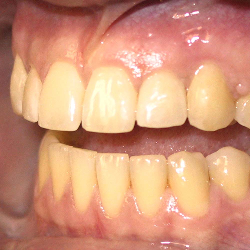 Yellow teeth: what causes them & do you need to worry about it? 16