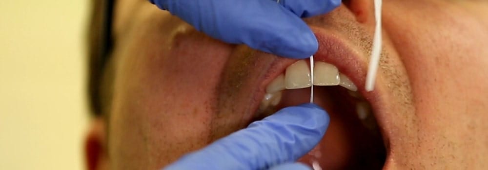 Floss being used on person by dentist