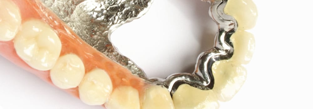 Dentures: a guide to types of false teeth & their costs 36