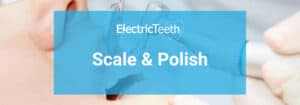 Dental scaling and polishing explained by a dentist 2