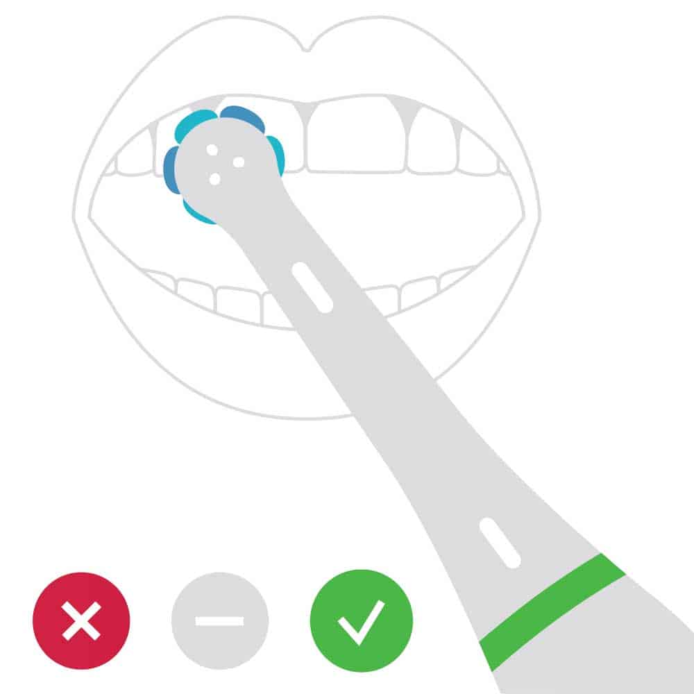 לאילו מברשות שיניים חשמליות יש חיישן לחץ? 3
