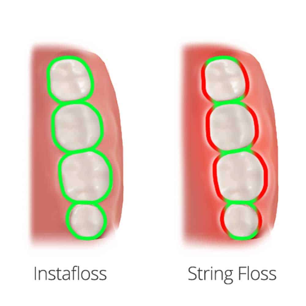 Instafloss vs String Floss
