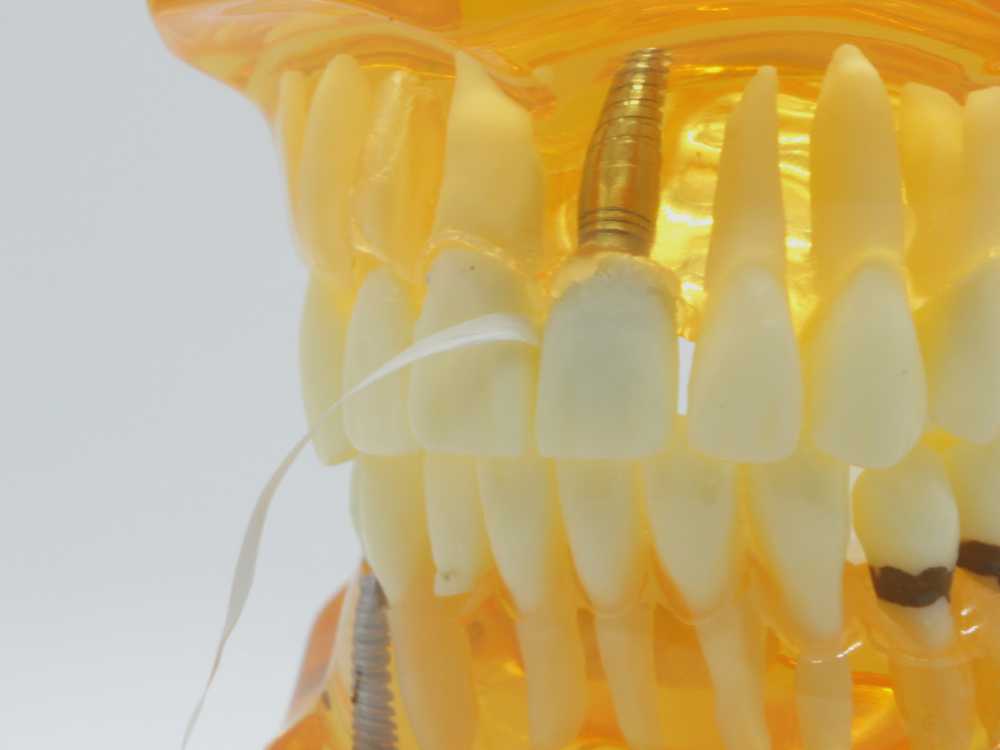 floss tape on scientific model of teeth