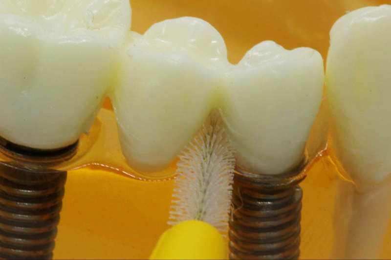 Close up of interdental brush being used on scientific model