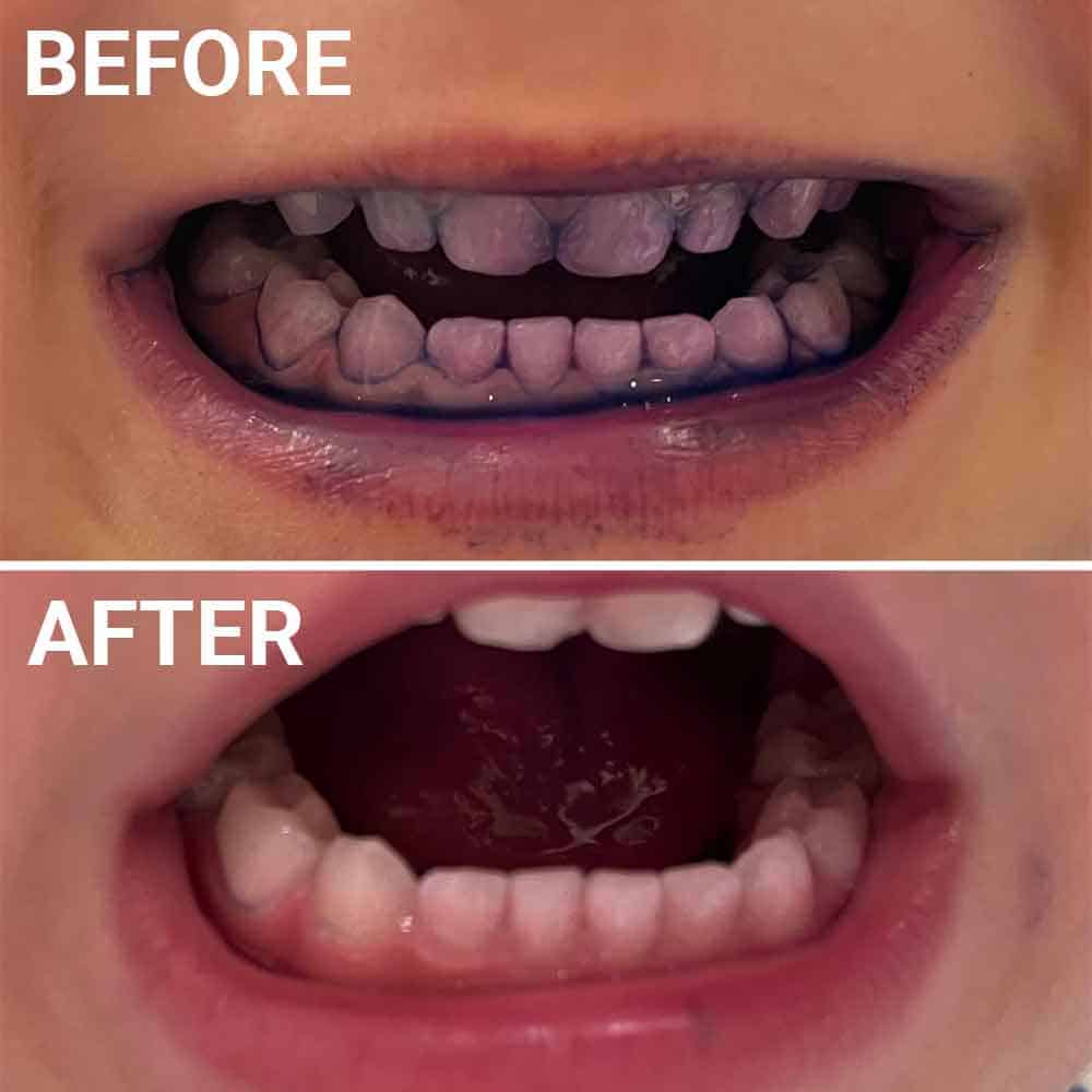 Wiggle Toothbrush Before & After