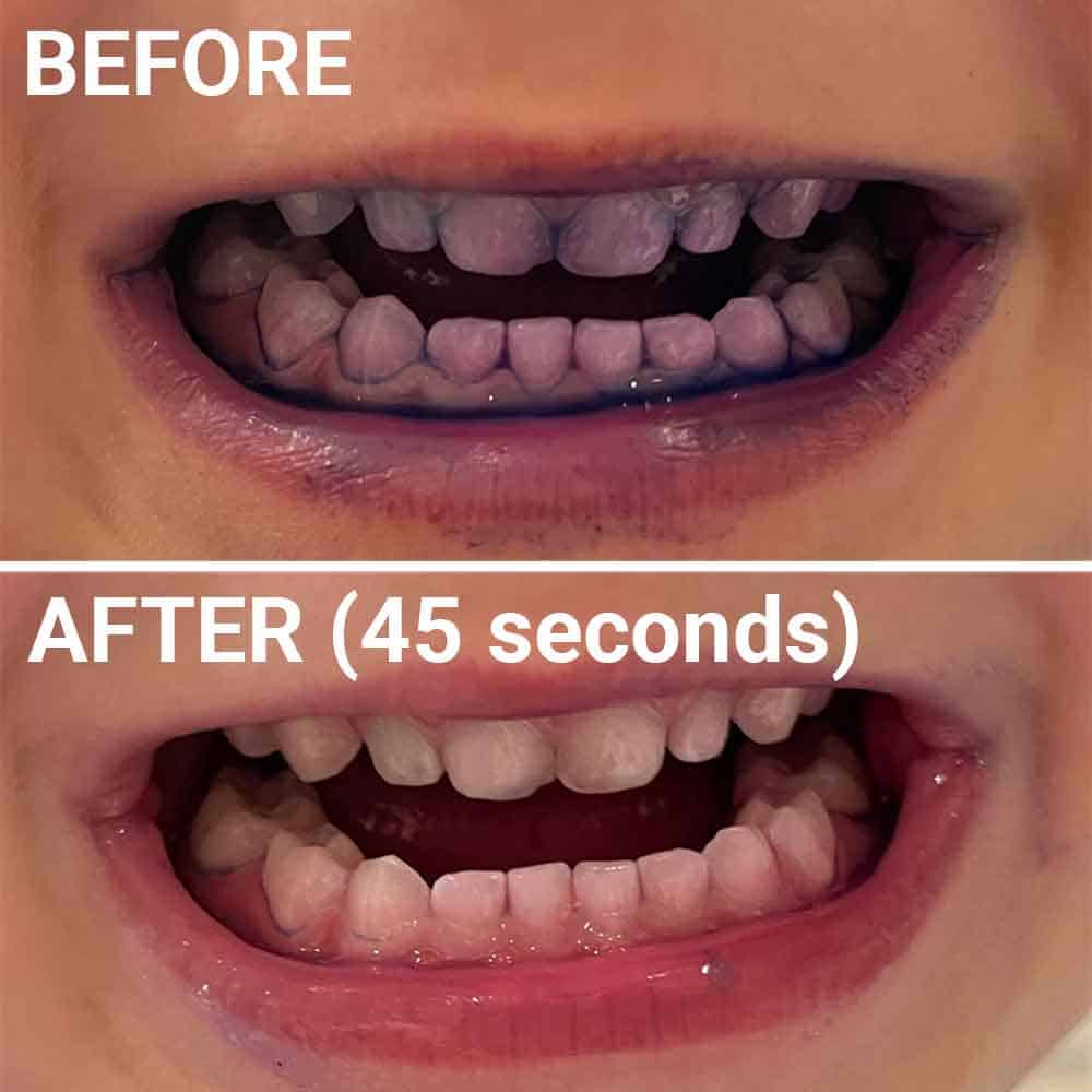 Whites Wiggle Toothbrush Cleaning Results 45 Seconds