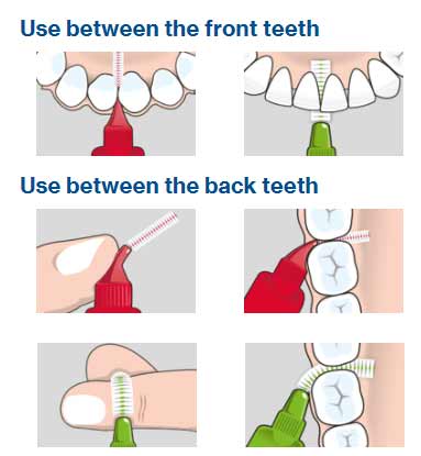 Best Interdental Brushes – A Guide To Buying & Using Them 12