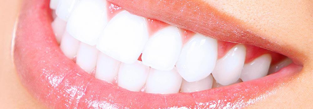 White teeth simle