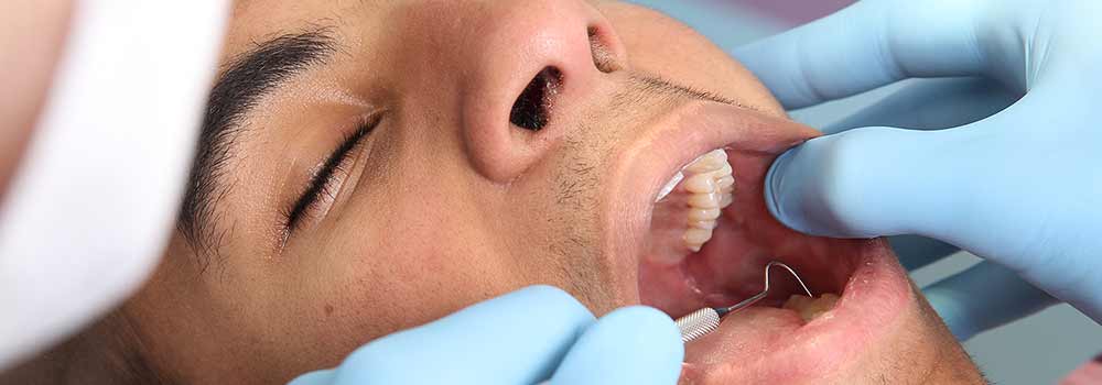 Wisdom Tooth Pain: Symptoms, Removal Procedure & FAQ 14