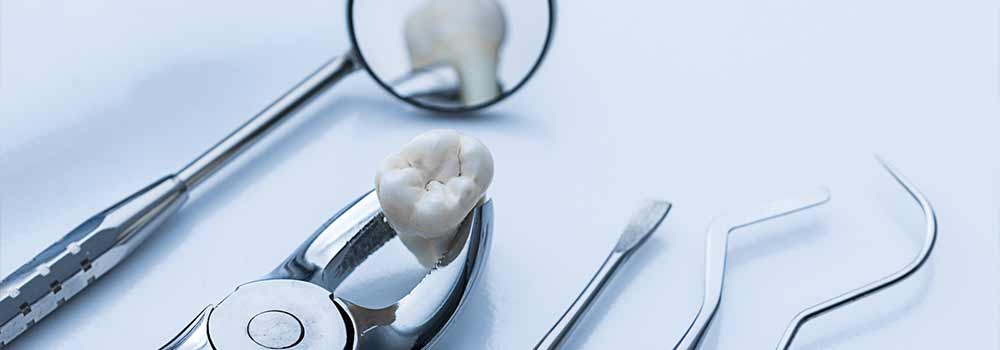 Wisdom Tooth Pain: Symptoms, Removal Procedure & FAQ 20