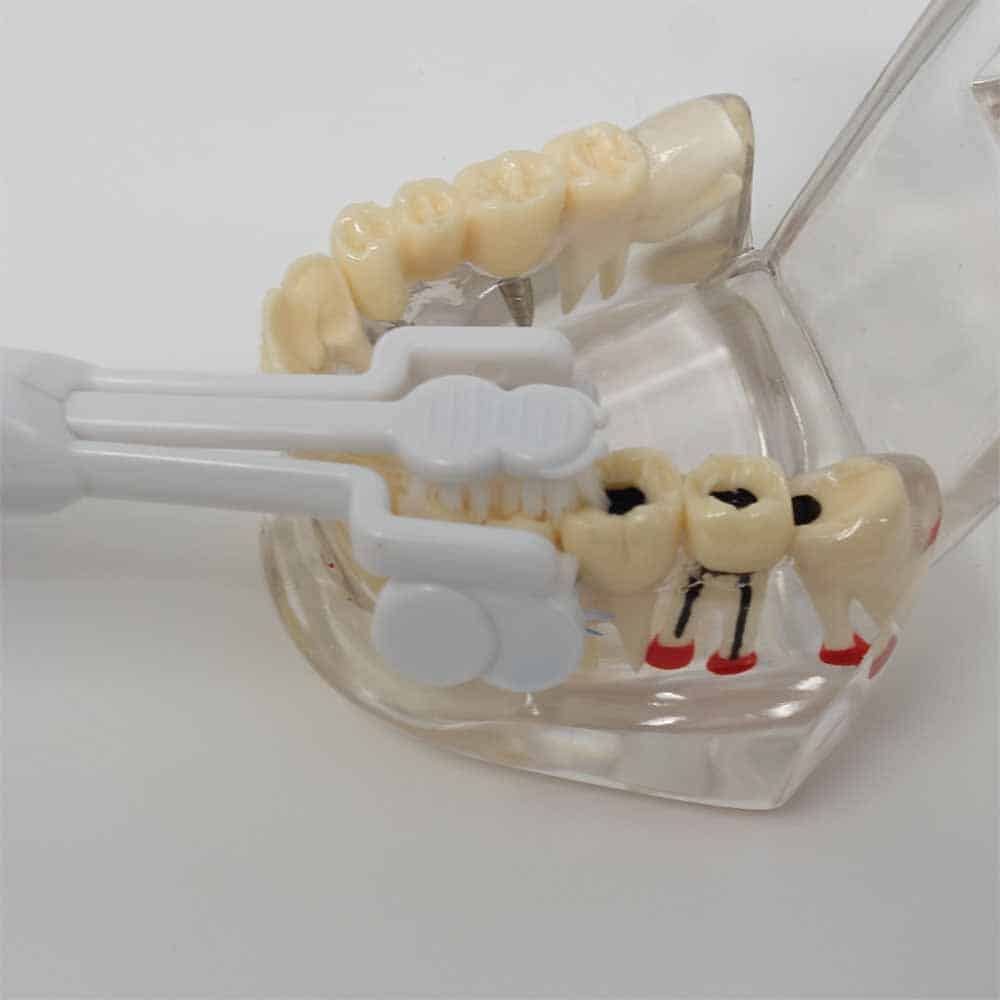 Triple Bristle toothbrush on model teeth