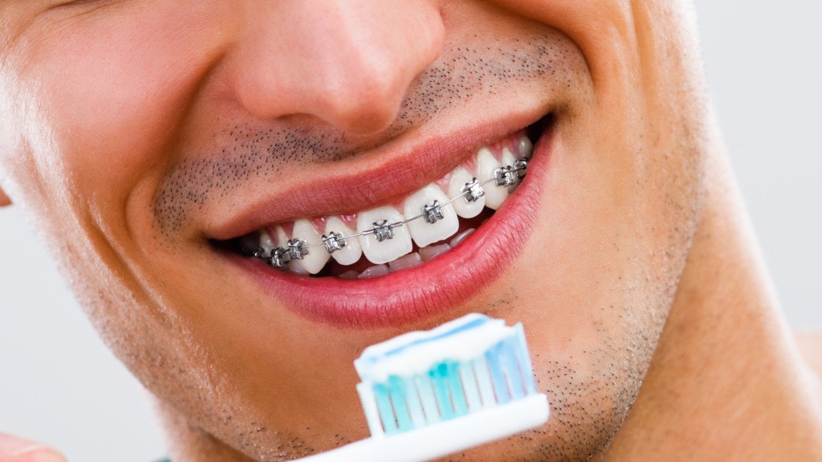 person with braces holding toothbrush in front of them with toothpaste on it